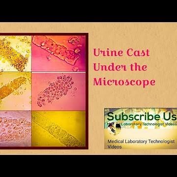 Urine Cast(Types and Causes), urinanalysis