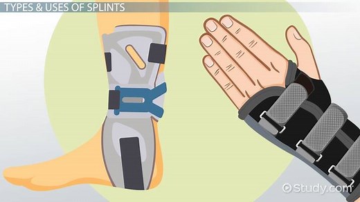 Splints in Occupational Therapy: Types & Uses