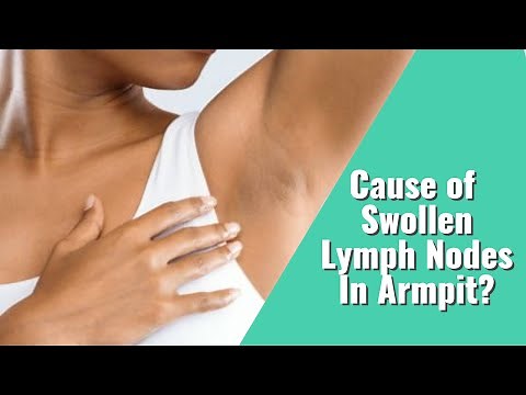 Swollen Lymph Nodes in Armpit & How To Know If It's Cancer Or Infection