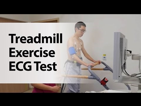 Treadmill Exercise ECG Test
