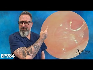 We Removed Infected Debris and Skin from Ear! - EP984