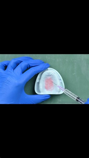 Cold Mould Seal & Base Plate – Made Easy From separating medium to smooth base plate, build the perfect denture foundation in a few simple steps. - Apply a thin, even coat of cold mould seal on the clean, dry cast to create a smooth separating film. - After it dries, adapt and wax‑up the record base, then pack heat‑cure acrylic into the flasked mold. - Process, deflask, trim, and polish to obtain a well‑fitting, rigid base plate ready for jaw relation records. Master the basics—perfect cold moul
