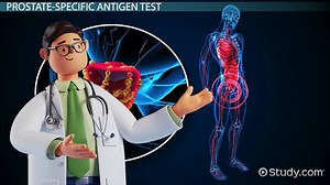 Prostate-Specific Antigen (PSA) Test: Definition & Procedure