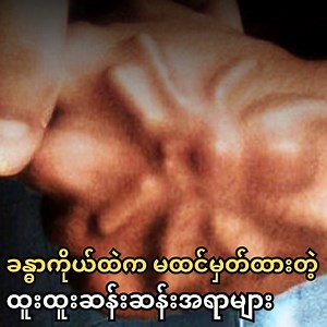 32K views · 1.7K reactions | လူ့ခန္ဓာကိုယ်ထဲမှာ တွေ့ရှိခဲ့ရတဲ့ ထူးထူးဆန်းဆန်း ကြောက်စရာအရာများ | Interest Knowledge | Facebook