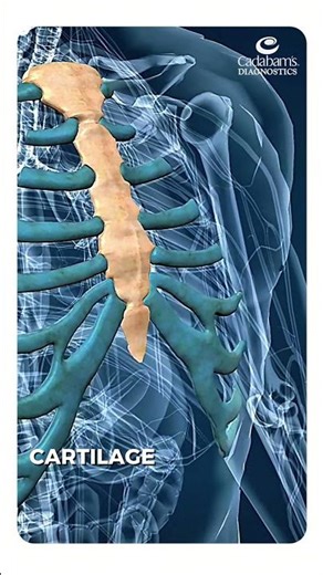 MRI vs Ultrasound in Musculoskeletal Imaging: Choosing the Right Tool for the Job