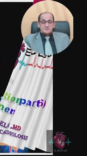 Atria Fibrilation Part 6 (1)