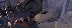 Laparoscopic Nissen Fundoplication | Journal of Medical Insight