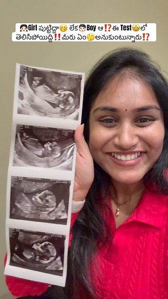 🤩ఎవరు పుడతారు👧🏻 full excited ఉన్నా‼️మరి మీరు⁉️#shorts #trending #pregnancy #ytshorts #teluguvlogs
