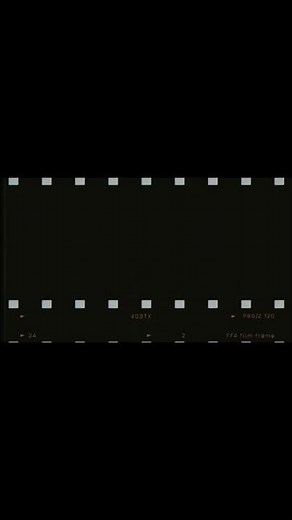 Shoulder Dislocation and Reduction Maneuver