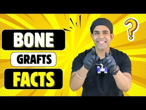 Bone Graft for Dental Implants | Safe Healing, Best Materials & Patient Guide