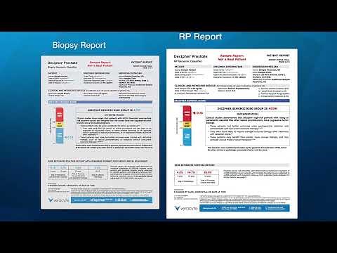 Decipher Test Report Overview