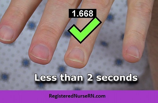 Capillary Refill Time