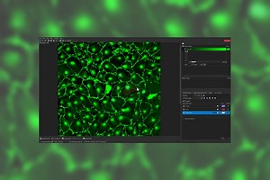 Using Machine Learning in Microscopy Image Analysis