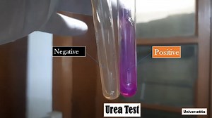 Urea Test: Principle, Procedure, Interpretation, Urease Positive Organisms,