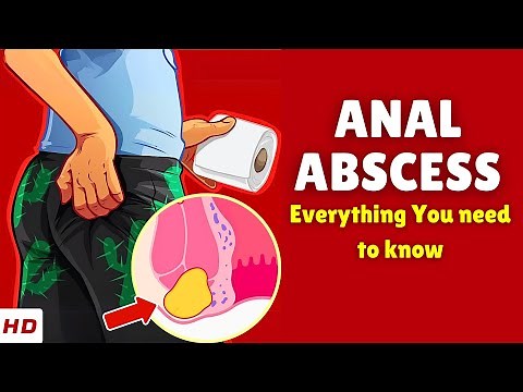 Anal Abscess Explained: Causes, Signs and Symptoms & Effective Treatments