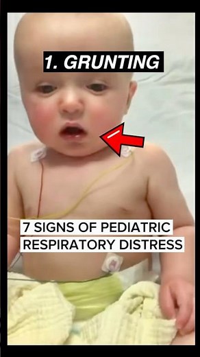 Doctor shows 7 signs of pediatric respiratory distress #emergency #medicine #pediatrics