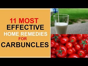 11 Most Effective Home Remedies For Carbuncles