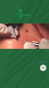 1.2K views · 63 reactions | ✨ Say goodbye to unwanted hair for good...