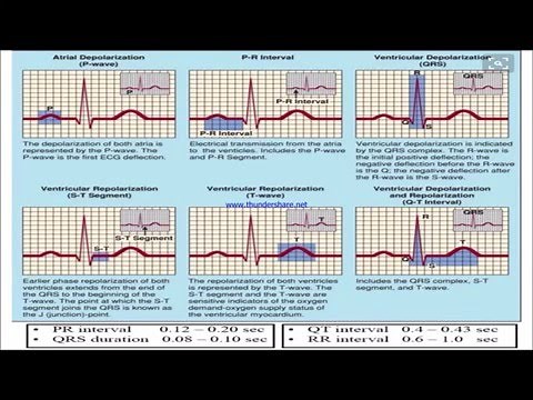 Normal and abnormal ECG