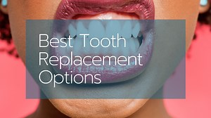 The 7 Best Tooth Replacement Options - [Jan 2026] : Reviews & Buying Guide