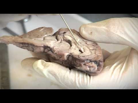 Sheep Brain Dissection