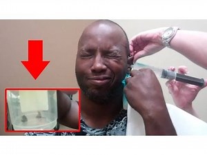 THIS MAY GROSS YOU OUT! HUGE EAR WAX!