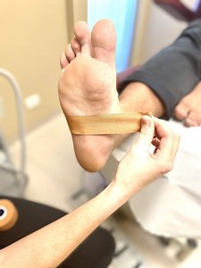 Low Dye Strapping | Healthy Life Foot Clinic
