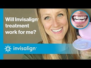 Will Invisalign® treatment work for me? | Invisalign