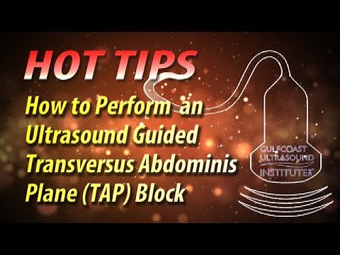 How to Perform an Ultrasound Guided Transversus Abdominis Plane (TAP) Block