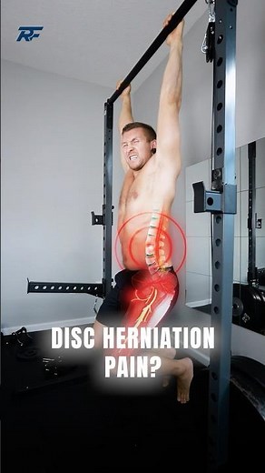 3-Step Disc Herniation Fix!