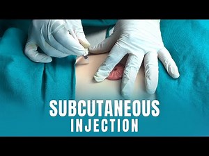Subcutaneous Injection | Step-by-Step Procedure (Nursing Skill)
