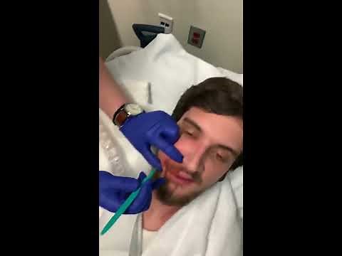 Facial abscess draining