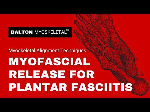 Use These Deep Tissue Myofascial Release Techniques for Plantar Fasciitis Treatment