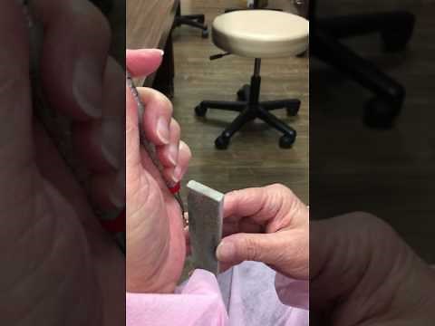 Dental Hygiene Instrument Sharpening Part 1