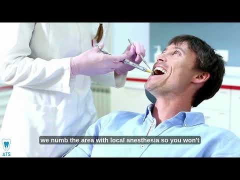 Dental Extraction | How Dental Extraction done | ATS Dental Clinic | Tooth Removal |Teeth extraction