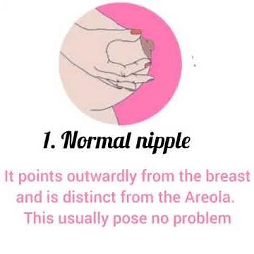 Types of Nipple