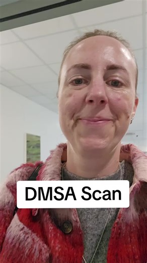 DMSA Scan done ✔️ this scan looks at which of my kidneys may be working better than the other so they can work out which one for me to keep and which one to give my friend. Just a few more tests to go now. #kidney #kidneyfailure #kidneydonor #kidneydisease #kidneytransplant #kidneyfiltration #dmsascan