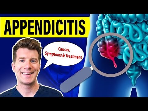 Doctor explains APPENDICITIS | Causes, symptoms and treatment