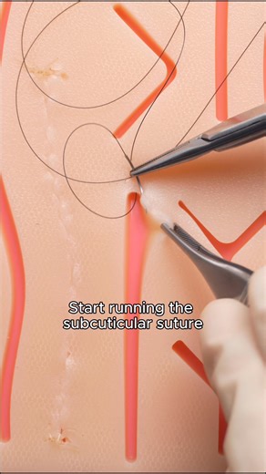 173K views · 925 reactions | There are multiple ways of starting a...