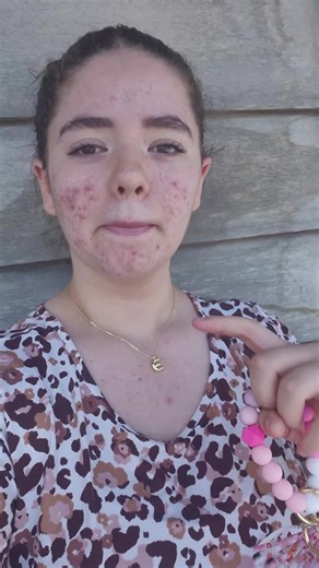 Creative Keychain Ideas for Women's Fashion