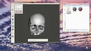 Medical 3D Model Creation: From CT Scan to 3D Printable STL File in 20 Minutes Using Free Software Programs 3D Slicer, Blender, and Meshmixer