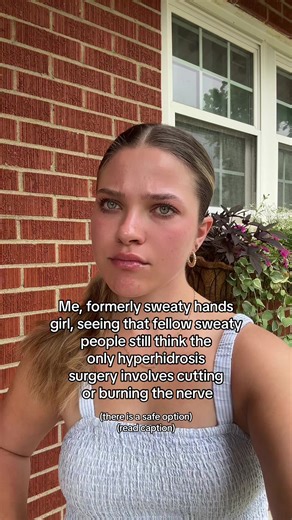 Surgery at The Center for Hyperhidrosis: The Endoscopic Thoracic Sympathectomy (ETS) is a 45 minute, minimally invasive, outpatient procedure for patients that experience sweaty hands (palmar hyperhidrosis). Small incisions are made in the chest and we place titanium clips at the nerve at the appropriate level. We do not cut or burn the nerve. We also do not deflate the lung. Underarms can also be helped during the procedure if desired! Out-of-state patients can fly home one day post-surgery, an