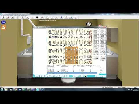 Eaglesoft Dental Charting