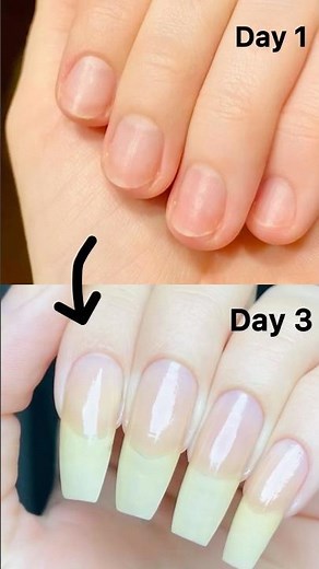 Grow Nails just in 3 Days [ Faster Growth ] | How to Grow Nails Fast || Faster Nail Growth Remedy |