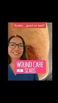 Scabs: Wound Care | ‪@LevelUpRN‬