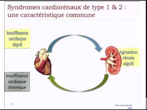 syndrome cardio-rénal