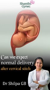 145 reactions | 擄 Can a normal delivery happen even after a cervical...