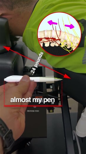 What 24 lbs of cervical decompression does for neck pain, numbness & tingling
