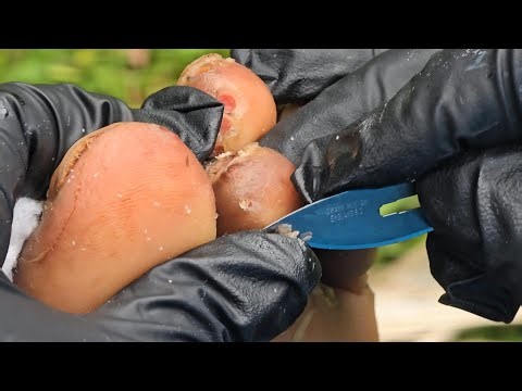 Save Julius Ombima's feel with a Rise Up Society subscription.