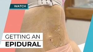 Getting an epidural